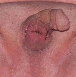 Castrated human, neutered human, eunuch, gelded man