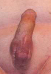 Castrated human, neutered human, eunuch, gelded man